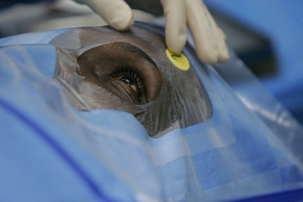 Joseph has his left eye prepped for cataract surgery at the Seven Hills Surgery Center in December.