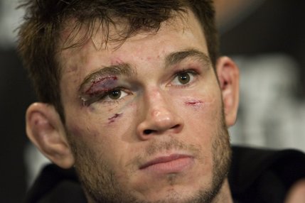 After getting so many stitches he 
