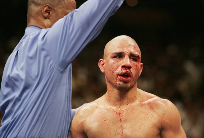 A bloodied Miguel Cotto is sent back to his corner by referee Kenny Bayless after he stopped the fight between Cotto and Antonio Margarito.
