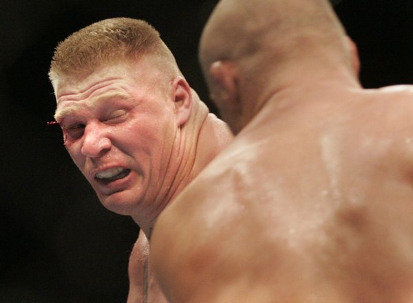 Challenger Brock Lesnar bleeds from a cut over his right ...