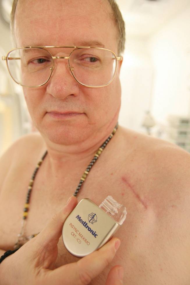 Billy Joe Hill holds a wireless Medtronic Vision 3D defibrillator like the one that was implanted into his chest.