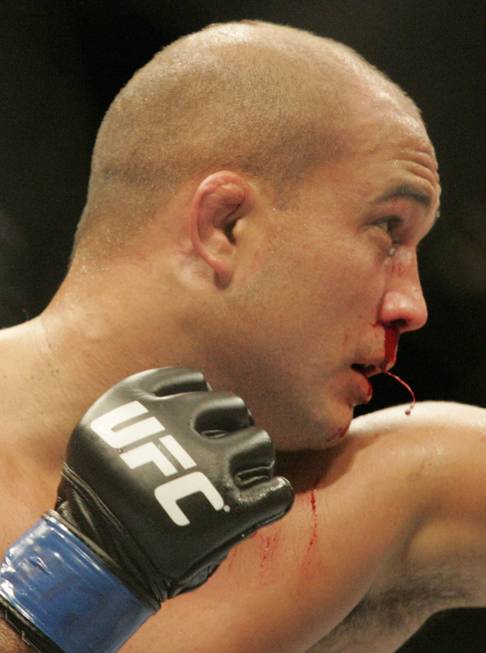Blood pours from the nose of B.J. Penn in the ...