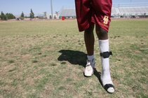 Del Sol football player compete with help of a prosthetic foot