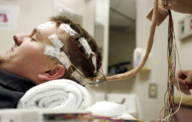 Chris Stones is fitted with 21 electrodes on his head at Sunrise Hospital & Medical Center Monday, October 13, 2008. The electrodes will monitor Stones' brain activity for several days, and his seizures will be induced to more accurately find the part of his brain where the seizures come from. 