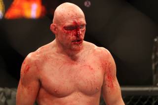A bloodied Keith Jardine takes a break during a stop in the action during his fight against Matt Hamill in the Ultimate Fighter Season 11 Finale at the Pearl inside the Palms last June. Jardine lost a split decision and the UFC released him shortly after.