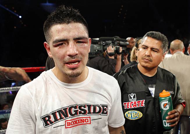 Brandon Rios, left, paces the ring after losing to Mike Alvarado in a super lightweight bout for an interim 140lb. WBO title at the Mandalay Bay Events Center Saturday, March 30, 2013. The fight was a rematch to a Oct. 13, 2012 fight  which Rios won.