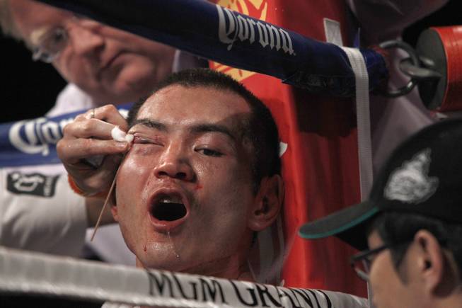 Nihito Arakawa of Japan is checked out in his corner between rounds during a lightweight fight against Jorge Linares of Venezuela at the MGM Grand Garden Arena on Saturday, March 8, 2014. 