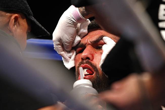 Alfredo Angulo of Mexico is treated in his corner between rounds during his super welterweight fight against Canelo Alvarez at the MGM Grand Garden Arena Saturday, March 8, 2014. 