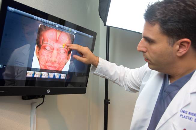 Dr. Christopher Khorsandi, of The Migraine Relief Center, shows the nerves in the forehead that are the cause of most chronic migraines, July 3, 2014.