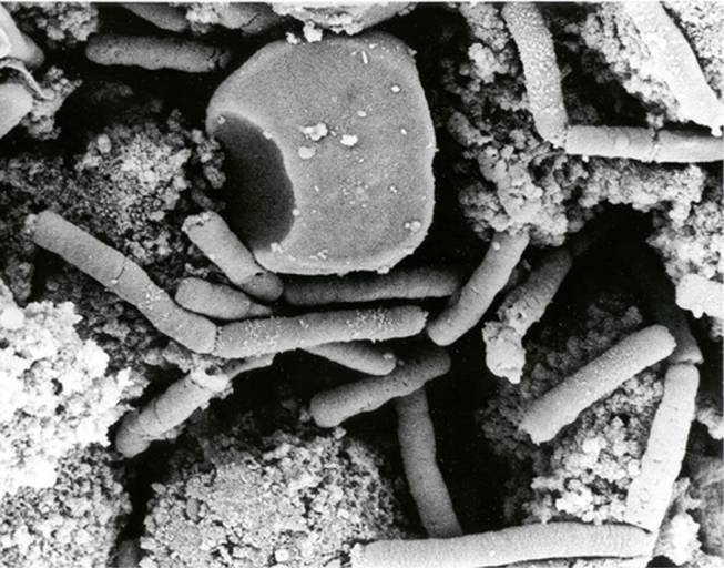 his undated file electronmicrograph from the official U.S. Department of Defense anthrax information Web Site shows Bacillus anthracis vegetative cells in a monkey spleen. Anthrax is an infectious disease caused by the spore-forming bacteria Bacillus anthracis. The Centers for Disease Control and Prevention said Thursday, June 19, 2014, that some of its staff in Atlanta may have been accidentally exposed to dangerous anthrax bacteria because of a safety problem at some of its labs.