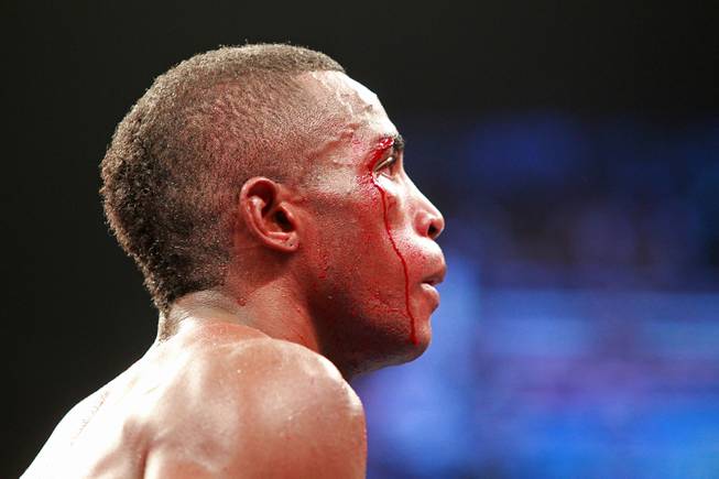 Erislandy Lara bleeds from a cut over his eye as he heads to his corner during his super welterweight fight against Saul "Canelo" Alvarez Saturday, July 12, 2014 at the MGM Grand Garden Arena. Canelo won a split decision.