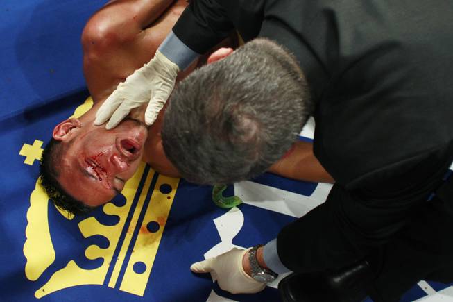 Pungluang Singyu is checked on after being knocked out in the 7th round by Tomoki Kameda during their WBO bantamweight title fight Saturday, July 12, 2014 at the MGM Grand Garden Arena. 