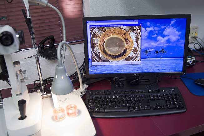 An image of a cornea is shown on a computer monitor at the Nevada Donor Network offices Tuesday, July 22, 2014.  The donated corneas are evaluated with a slit lamp microscope to check for a variety of problems.