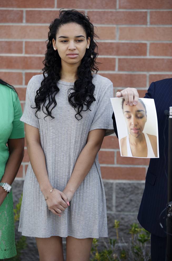 Ariana Mason attends a news conference as her attorney E. Brent Bryson holds up a picture of her Thursday, April 23, 2015, in Las Vegas. Mason is suing Las Vegas police and an officer she says smashed her face into a glass topped table during her arrest during a scuffle last August at a Strip resort nightclub.