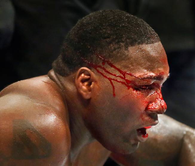 UFC light heavyweight contender Anthony Johnson sits bloodied on the canvas by opponent Daniel Cormier as the round ends mercifully during their UFC 187 fight at the MGM Grand Garden Arena on Friday, May 22, 2015.