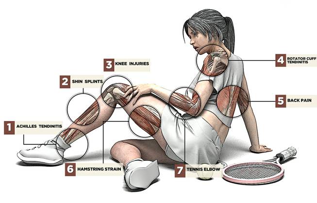 illustration of injuries female tennis player