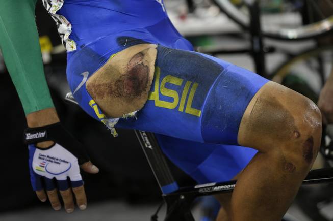 Brazil's Gideoni Monteiro pedals his warm-up bike with a ripped skinsuit after falling during the men's omnium elimination track cycling competition at the Pan Am Games in Milton, Ontario, Thursday, July 16, 2015. Monteiro completed the race and finished second after the fall. 