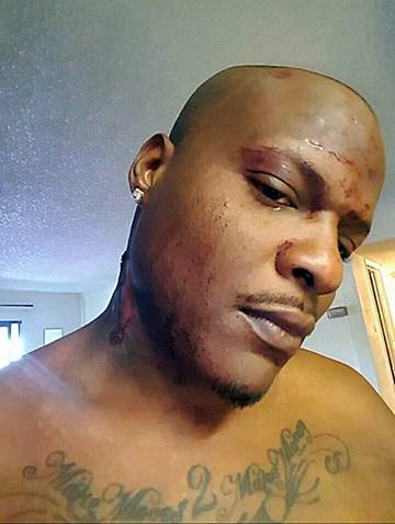 Qaadir Isaam Amin II, a suspected hit-and-run driver in a fatal North Las Vegas crash, is shown in a photo apparently uploaded on social media by Amin that shows injuries he claims were suffered in the crash.