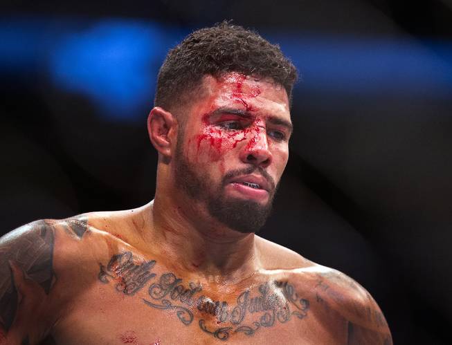 Welterweight Max Griffin is bloodied from opponent Colby Covington between rounds during the UFC 202 fight night action at the T-Mobile Arena on Saturday, August 20, 2016.