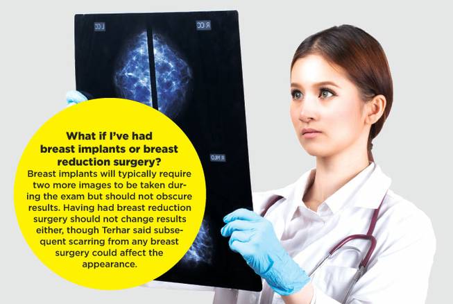 HCA mammogram FAQs native