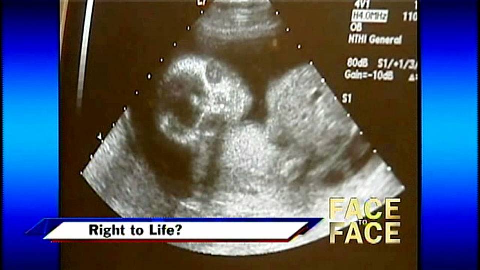 Right to Life?