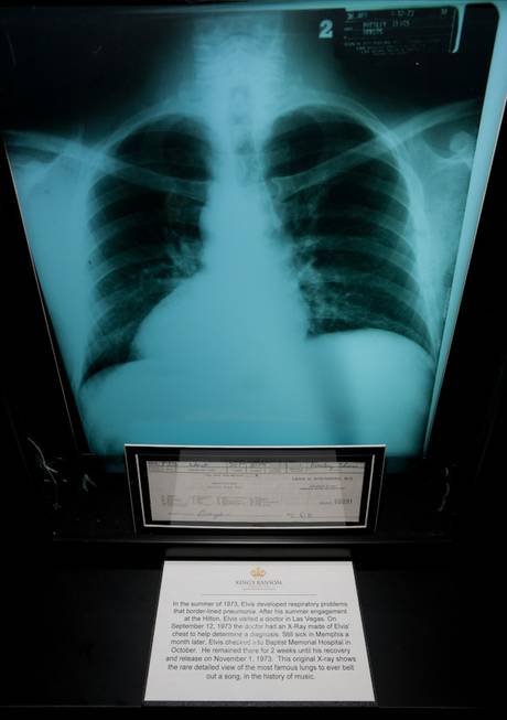 Elvis Presley's X-Ray at King's Ransom Museum's Elvis Presley exhibit ...