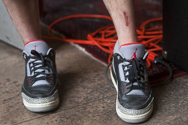 Jordan Michael Geller shows off an injury he received while working on the ShoeZeum at the Neonopolis mall in downtown Las Vegas Thursday, Aug. 30, 2012. The collection has 2,500 pairs of new Nike shoes.