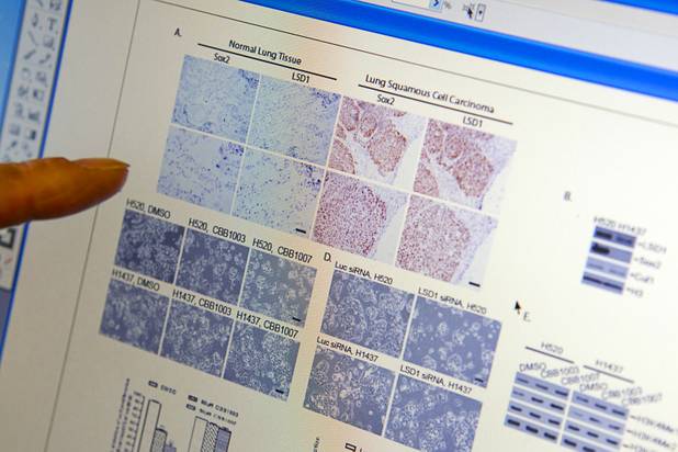 New UNLV professor Hui Zhang points to photos on a computer screen that show normal lung tissue, left, in his office at UNLV Tuesday, Oct. 9, 2012. Cancerous tissue is shown at upper right. Hui, a molecular biologist, came to UNLV after five years at the Nevada Cancer Institute.