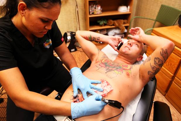 Technician Magdelyn Vasquez-Castro removes a tattoo from the stomach of ...