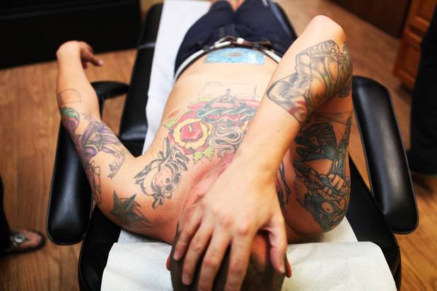Technician Magdelyn Vasquez-Castro removes a tattoo from the stomach of ...