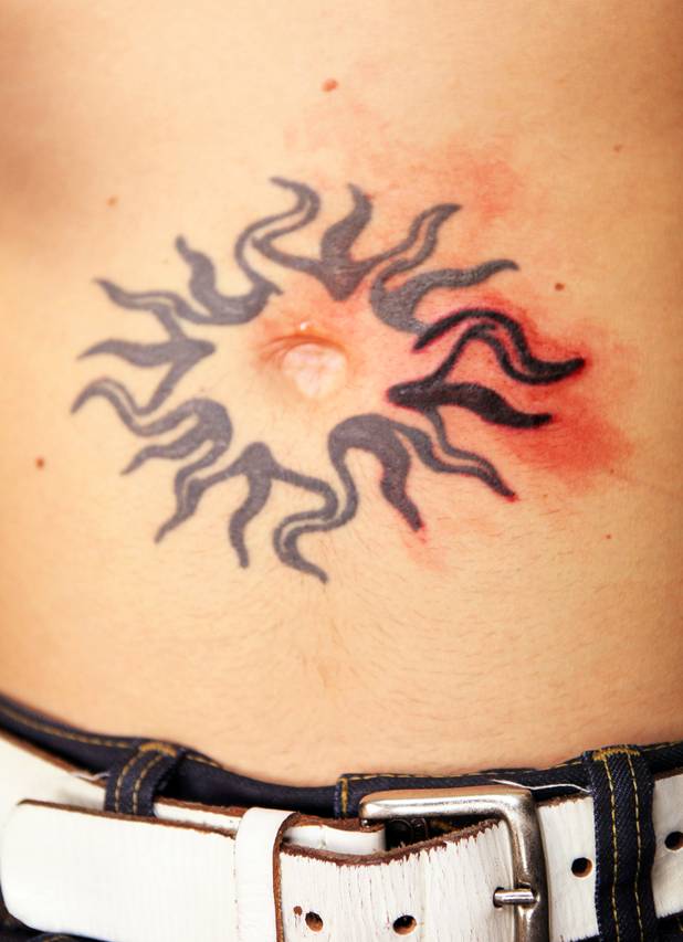 Technician Magdelyn Vasquez-Castro removes a tattoo from the stomach of ...