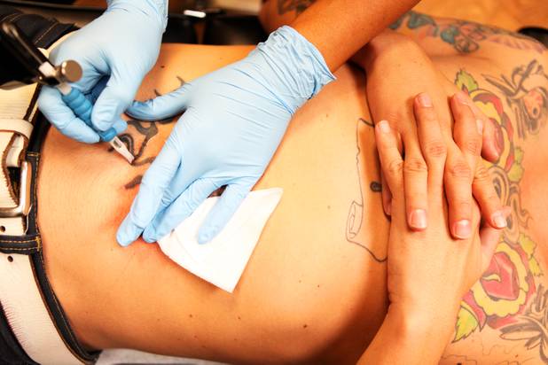 Technician Magdelyn Vasquez-Castro removes a tattoo from the stomach of ...