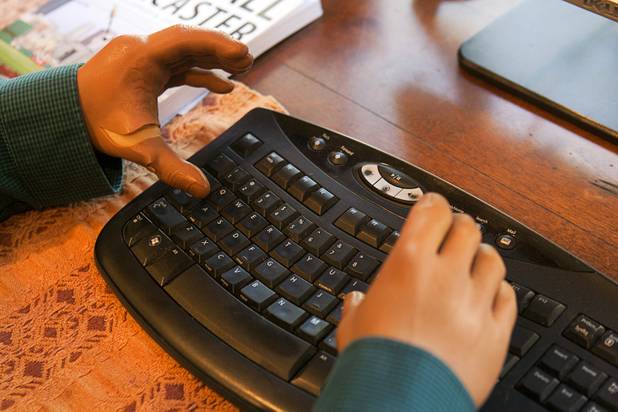 Scott Martin, who lost his hands and feet due to the flesh eating disease, types with his thumbs  at his home Wednesday, Dec. 12, 2012. He wrote a passage for Chicken Soup "Power of Positive" and is working on a memoir.