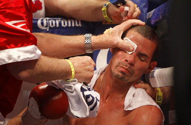 WBA lightweight champion Richard Abril of Cuba is treated by members of his corner between rounds during his title fight against Sharif Bogere of Uganda at the Hard Rock Hotel in Las Vegas, Nevada March 2, 2013. Abril retained his title with a unanimous decision victory.