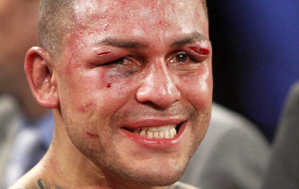 Mike Alvarado is shown following a super lightweight bout for an interim 140lb. WBO title against Brandon Rios at the Mandalay Bay Events Center Saturday, March 30, 2013. Alvarado won the fight by unanimous decision. The fight was a rematch to a Oct. 13, 2012 fight  which Rios won.