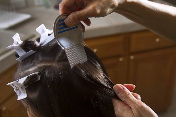 Michelle Lohrli, co-owner of Lice Happens, a mobile lice-removal service, demonstrates her technique on her daughter at her home Sunday, July 28, 2013. The business is part of a national franchise system.