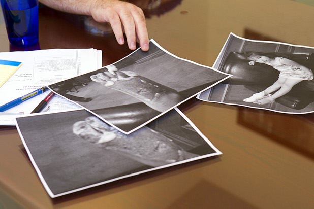 Attorney George Tractman displays photos of Jamileth Dominguez-Hernandez's injured foot during an interview at the law offices of Langford McLetchie on Monday, Aug. 5, 2013. The firm is representing a family who is suing Metro Police for failing to properly investigate when their daughter had her foot injured in an accident in 2011.