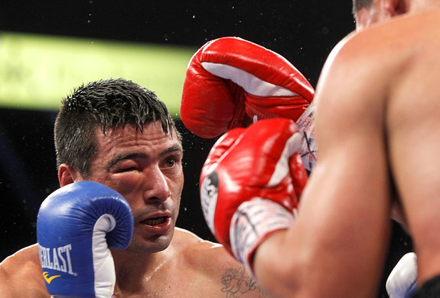 The swollen right eye of Lucas Matthysse of Argentina is shown during his title fight against WBC/WBA junior welterweight champion Danny Garcia at the MGM Grand Garden Arena Saturday, Sept. 14, 2013. Garcia retained his title with a unanimous decision.