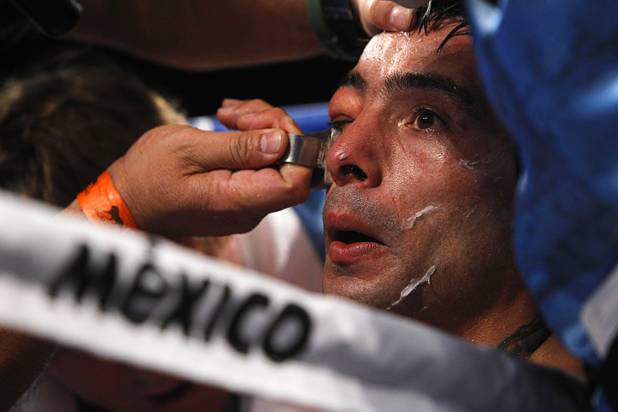 Boxer Lucas Matthysse of Argentina is treated in his corner between rounds during his title fight against WBC/WBA junior welterweight champion Danny Garcia at the MGM Grand Garden Arena Saturday, Sept. 14, 2013.