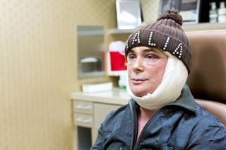 Las Vegas headliner Frank Marino waits to meet with his plastic surgeon regarding the recovery of his recent procedure Dec. 10, 2013.