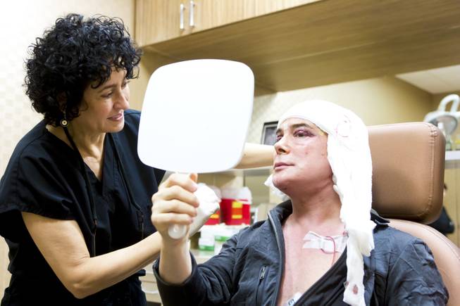 Dr. Goesel Anson and Frank Marino examine Marino's face Dec. 10, 2013 during a routine check-up following a recent plastic surgery procedure.