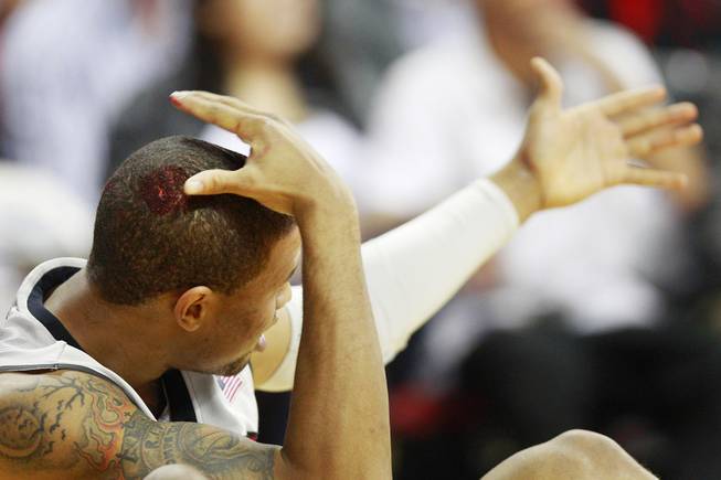 UNLV guard Bryce Dejean-Jones grabs his head after it was cut by the elbow of a Utah State player during their game Wednesday, Jan. 22, 2014 at the Thomas & Mack Center. Dejean-Jones left the game briefly and came back with two staples in the wound.