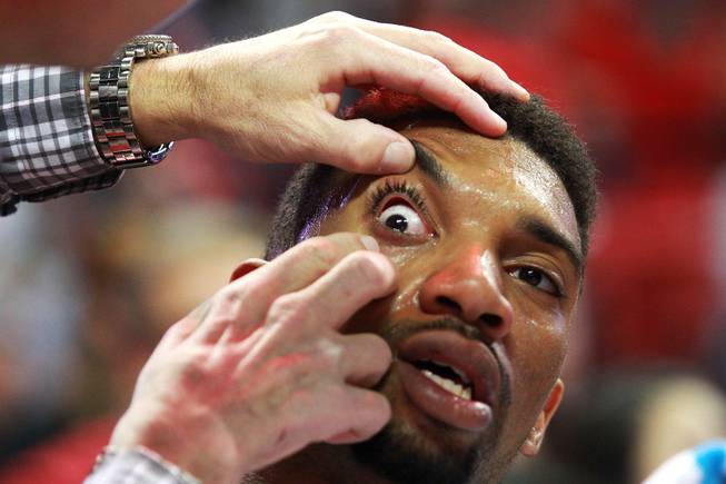 UNLV forward Khem Birch has his eye attended to during their game against Fresno St. Saturday, Jan. 25, 2014 at the Thomas & Mack Center. UNLV won 75-73 in overtime.