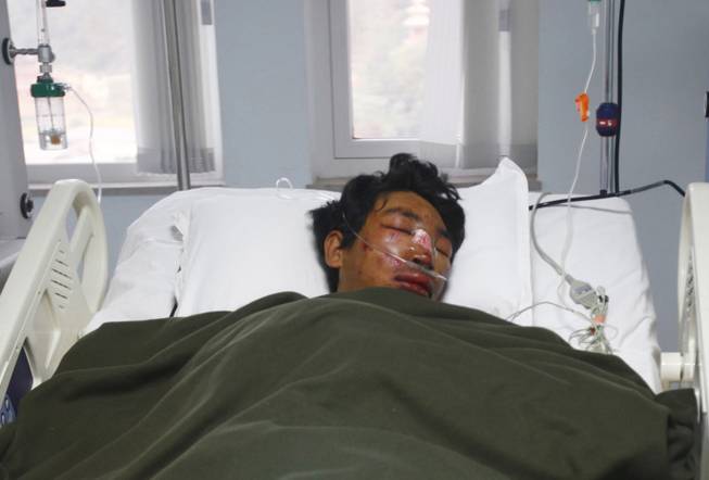 A Nepalese Sherpa Dawa Tashi, who was injured during an avalanche, gets treatment at a hospital in Katmandu, Nepal, Friday, April 18, 2014.