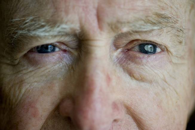 Dan Dunbar, 82, poses for a portrait at his home in Costa Mesa, Calif., on Wednesday, March 12, 2014. Dunbar has age-related macular degeneration. In November 2011, he had a telescope implanted in his left eye to improve his vision.