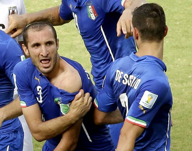Italy's Giorgio Chiellini displays his shoulder showing apparent teeth marks after colliding with the mouth of Uruguay's Luis Suarez during the group D World Cup soccer match between Italy and Uruguay at the Arena das Dunas in Natal, Brazil, Tuesday, June 24, 2014.