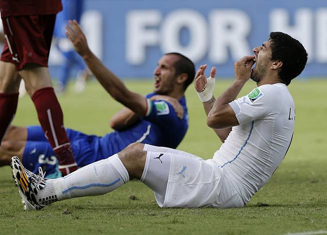 Uruguay's Luis Suarez holds his teeth after biting Italy's Giorgio Chiellini's shoulder during the group D World Cup soccer match between Italy and Uruguay at the Arena das Dunas in Natal, Brazil, Tuesday, June 24, 2014. 