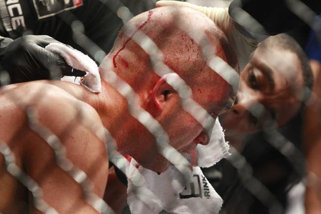 B.J. Penn's face is attended to after Frankie Edgar scored a third round TKO over him at "The Ultimate Fighter" 19 finale Sunday, July 6, 2014 at the Mandalay Bay Events Center.
