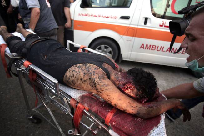 Palestinian medics wheel a wounded man, following an Israeli Strike in Shijaiyah neighborhood, to the emergency room of the Shifa Hospital, in Gaza City, Wednesday, July 30, 2014.