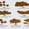Photo: HCA what your poo says about you native